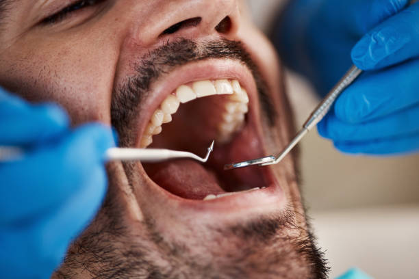 Best Cosmetic Emergency Dentistry in Villanova, PA