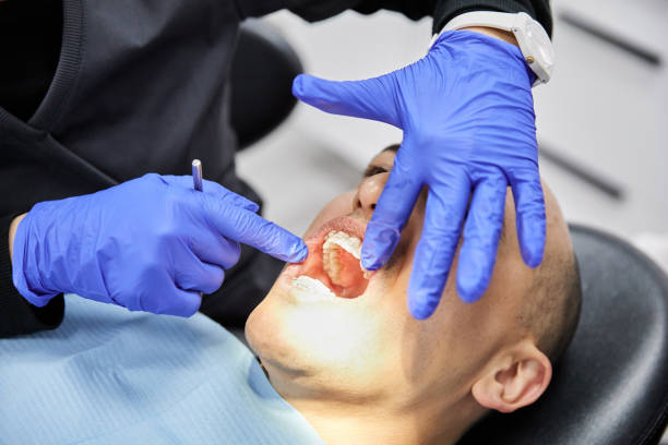 Best Emergency Tooth Extraction in Villanova, PA